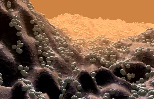Бактерии кокки
